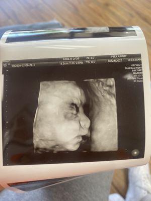 27 week ultrasound