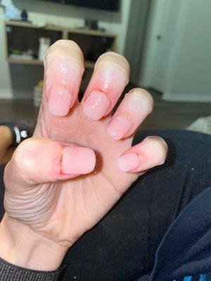 Cut cuticles