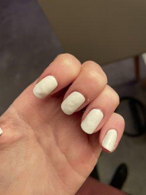 bumpy nails