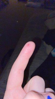 A simple finger poke turned into a sliced open finger.