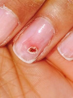 My nails after a gel removal @ Essential Day Spa, Hyattsville