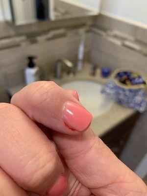 Deep cut from Cindy ripping off my cuticles.