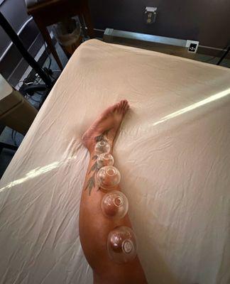 Cupping