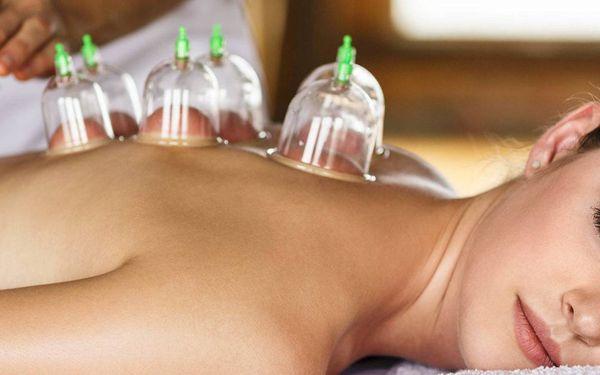 Cupping therapy for MFR