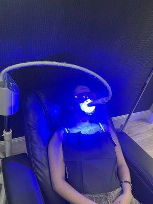 Teeth whitening