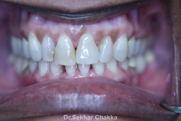 Sekhar Chakka, DDS - Stadium Dental & Orthodontics