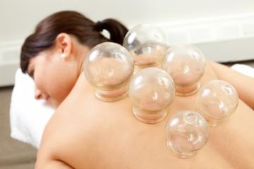 Cupping for stress-related back tension