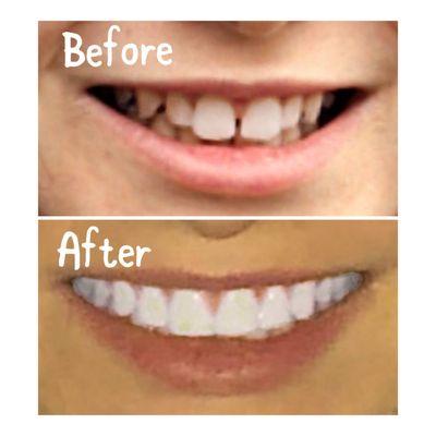 Amazing Transformation by Mizrahi Orthodontics!