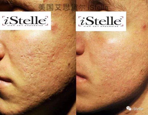 Loving our iStelle skin enhancer and cream!!! RESULTS