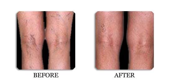 Vein and Skin Laser Center