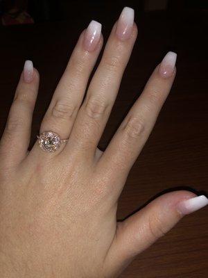 My engagement ring!