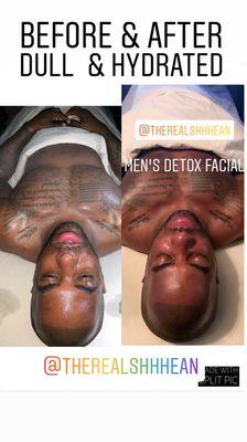 Men's Detox/Hydration facial