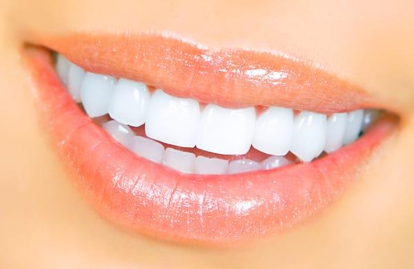 A beautiful smile says it all without the need of words. With Veneers we can help you get that beautiful smile you've always wanted!