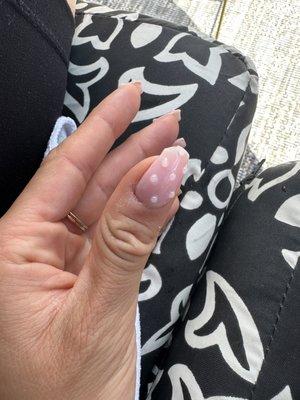 Broken nail