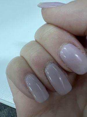 No cuticle treatment.