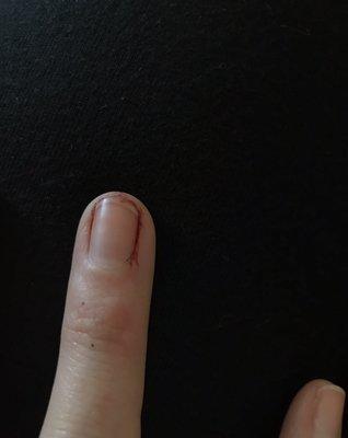 See Review, but this injury was caused by the nail techs FINGERNAIL not a tool.