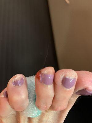 The worst pedicure I've ever received. And I was still charged for it. Left bleeding and with uneven polish.