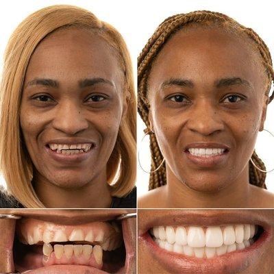 JAX Dental Implants & Dentures