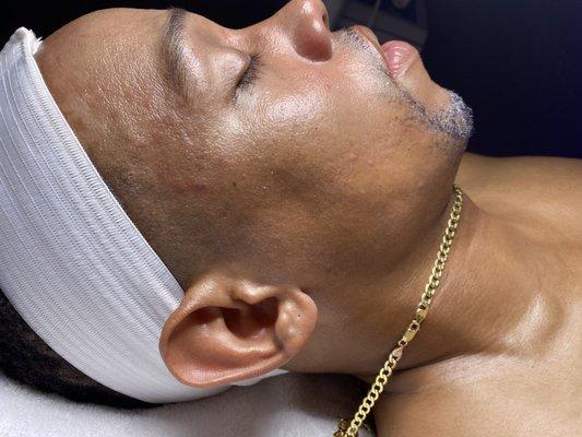 Our Mens Facial