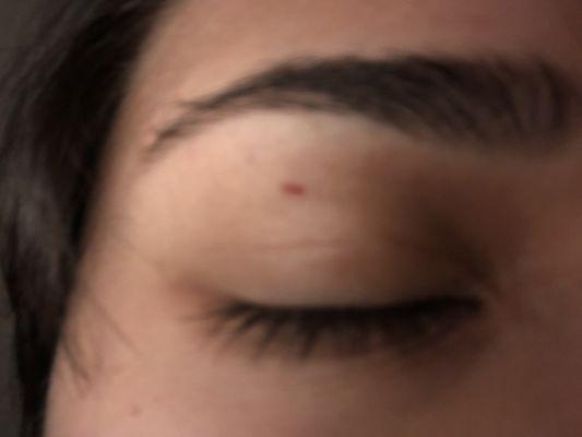 Bigger cut under my brow