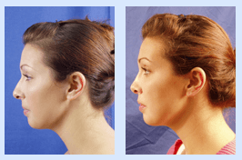 Florida Ear Nose Throat & Facial Plastic Surgery