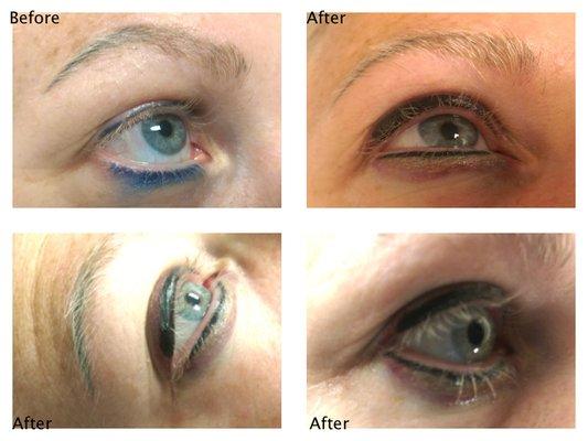 Eyeliner Correction