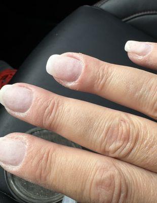 Awful nails on two people