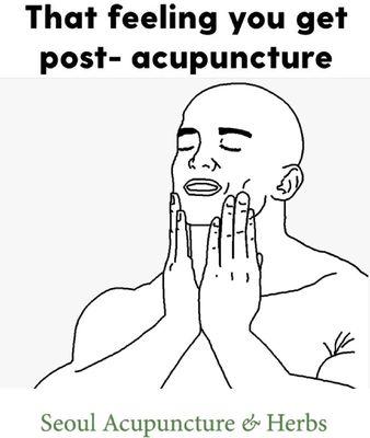 Acupuncture will make your day!