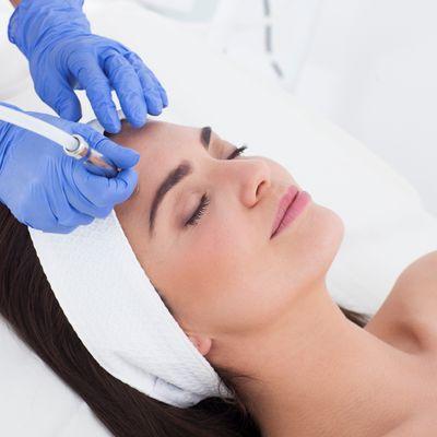 Diamond Microdermabrasion