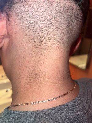 Left all this neck hair