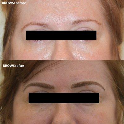 Brows: before and after