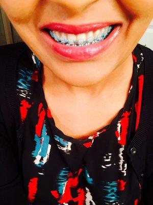 Dr. Sarah's  braces...#AestheticDentistry #CrystalClearFamilyDentisrty