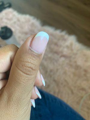 Red dot under nail color and bumpy surface.