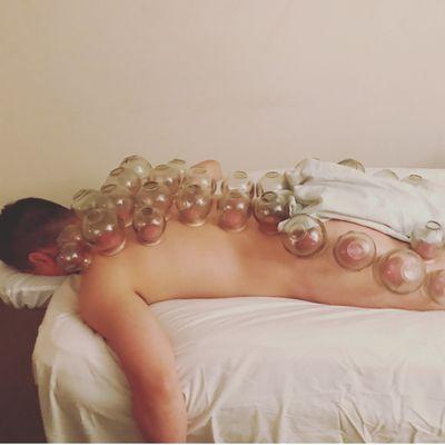 Extreme Sports Cupping