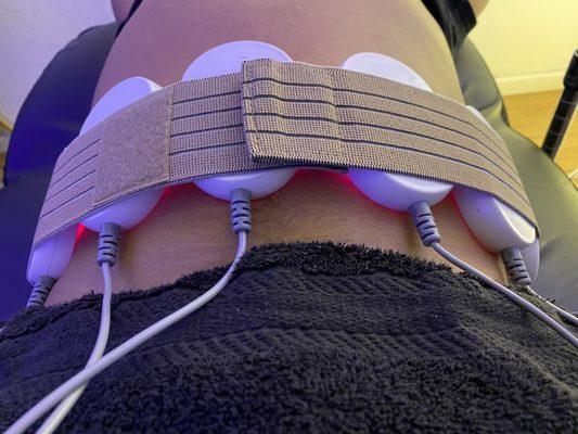 Non invasive laser lipo