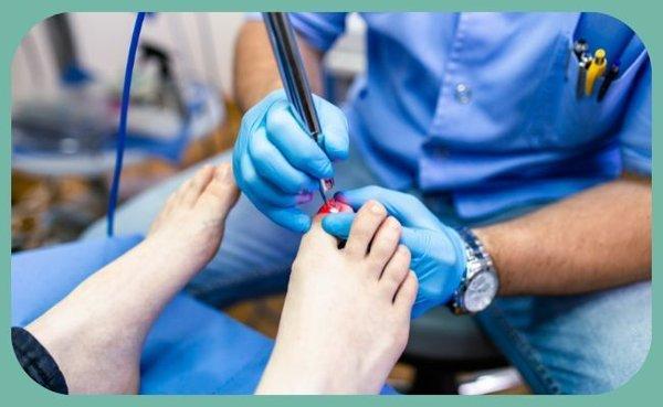 Fungal Nail Treatment in Fort Collins, CO