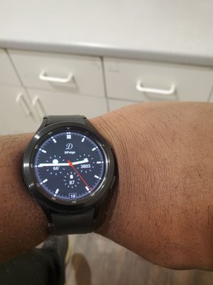 My watch is showing the time now