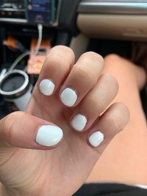 Terrible nails