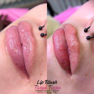 Lip Blush was done to enhance her shape and add a touch of color.