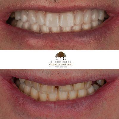 Cherry Creek Restorative Dentistry