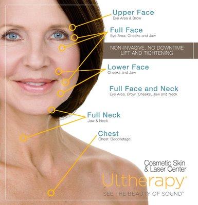 Ultherapy