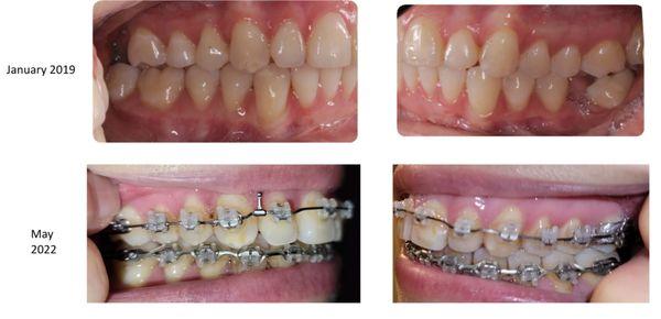 Touni Orthodontics: Walied Touni, DDS, MSD