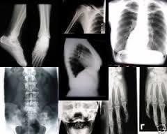 SKELETAL X-RAYS TAKEN, PROCESSED, AND THOUROUGHLY EVALUATED BY DR. LEE ON THE SAME DAY!