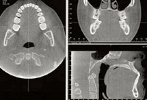 CT Scan Imaging