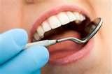 Maintain a good oral Hygiene with routine CheckUps