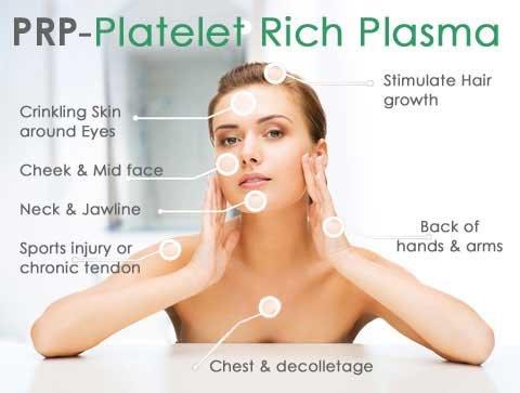 Platelet Rich Plasma Treatment! www.medimeinskincare.com