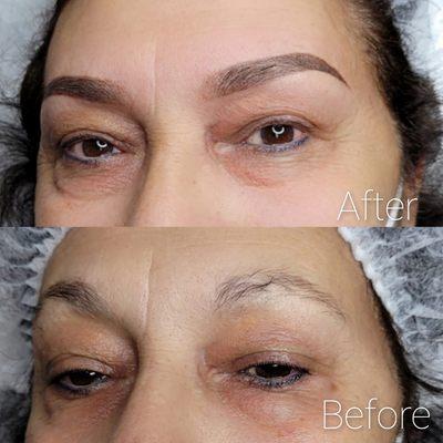 Inital procedure for semi permanent brows