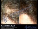 Stop hair from thinning Start regrowing your hair