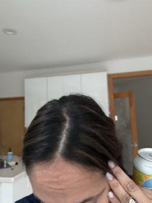 Roots, 3 days after appointment.