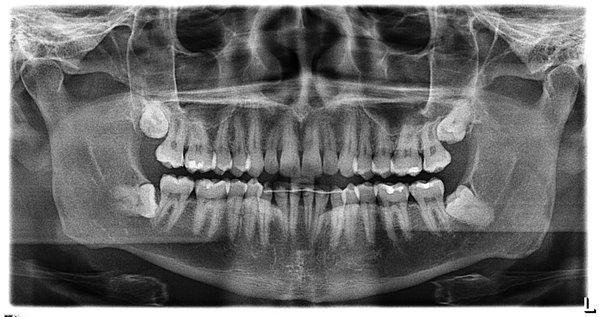 Gordon Mathew, MD DDS